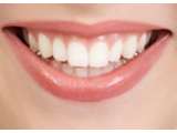 TIPS: Cara Memutihkan Gigi yang Kuning
