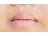 5 Alasan Jangan Remehkan Bibir Pucat
