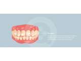 Cara Mencegah Terjadinya Fluorosis pada Gigi