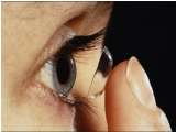 Bahaya Lensa Kontak Mata Bagi Kornea Mata