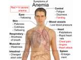 Penyakit Anemia